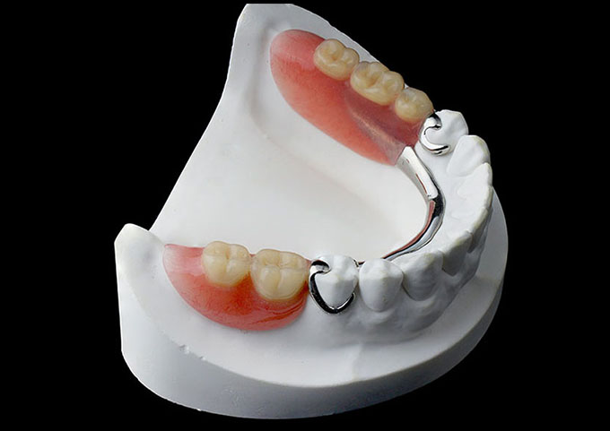 Dentures & Partials