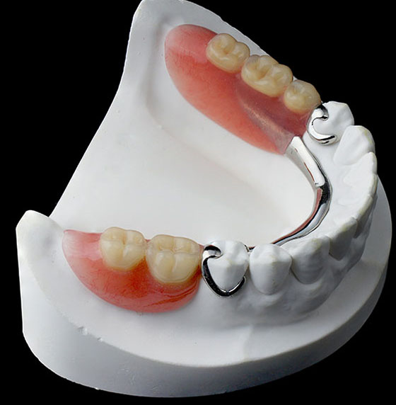Dentures & Partials